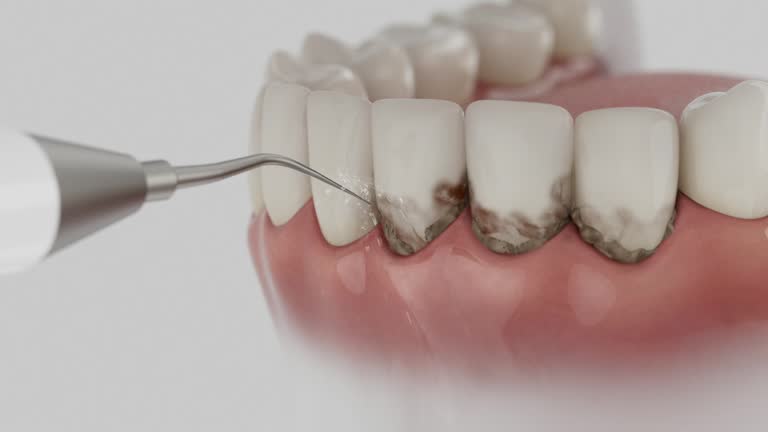 Reliable Dental Implants contractor in Blacklick Estates, OH by Smile Center Dentistry